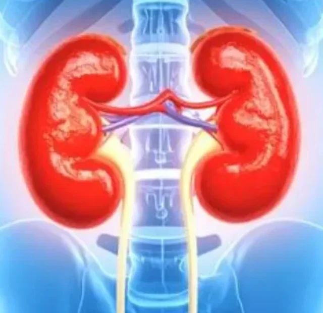 cropped-kidney-stones.webp